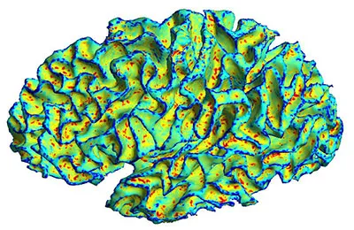 High Performance Computing & Numerical Analysis